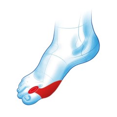 Νάρθηκας για το Κότσι